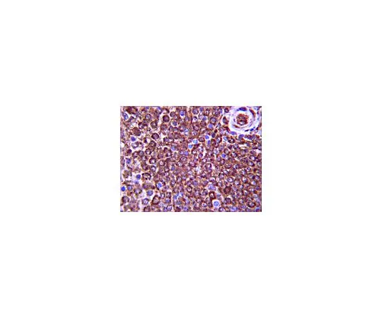 62-8388-73　［已停用］抗PI3激酶-C2β;100μg　7-70