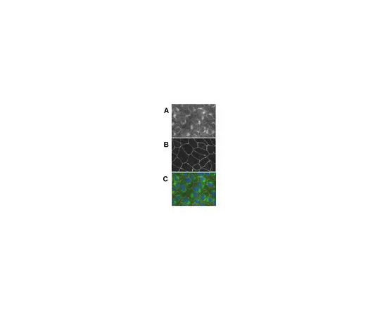 62-8386-34　［已停用］反Pals1;100μL　07-708