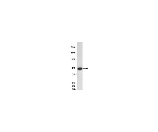 62-8385-40　［已停用］抗p47-phox (鼠标);100μg　07-500
