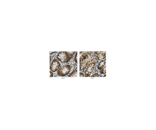 62-8466-44　［已停用］抗GRPR抗体猫。不，ABN295　ABN295