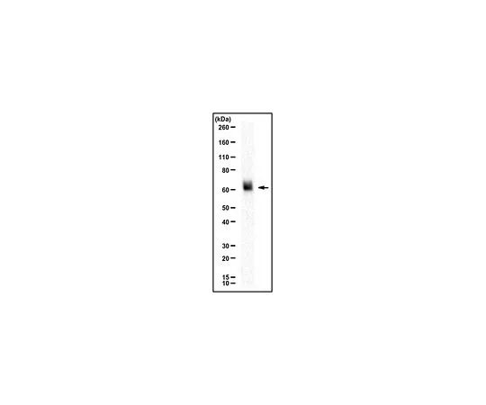 62-8467-99　［已停用］抗ENTPD1抗体　ABN1008