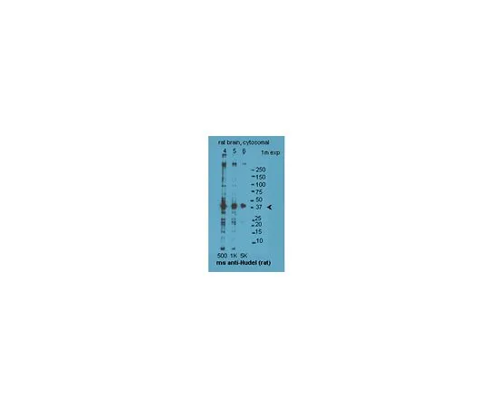62-8455-70　［已停用］反NUDEL;100μL　AB15664