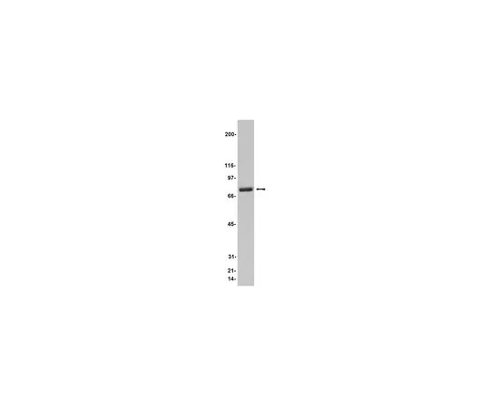 62-8383-74　［已停用］抗莫伊辛;200μg　07-121