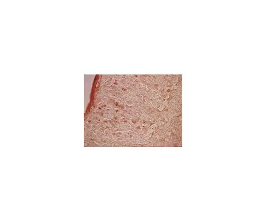 62-8452-10　［已停用］抗MAML1;100μg　AB5975