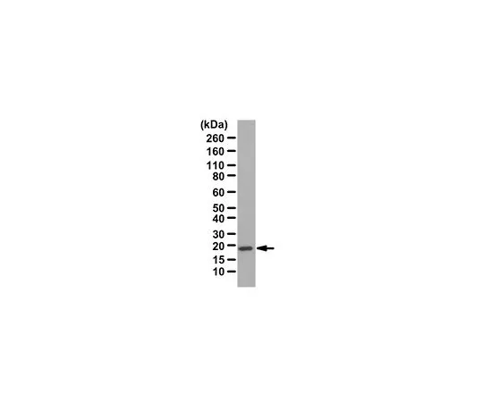 62-8472-91　［已停用］抗克劳丁-1　ABT147