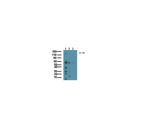 62-8453-82　［已停用］抗MAGI-2;100μg　AB9878