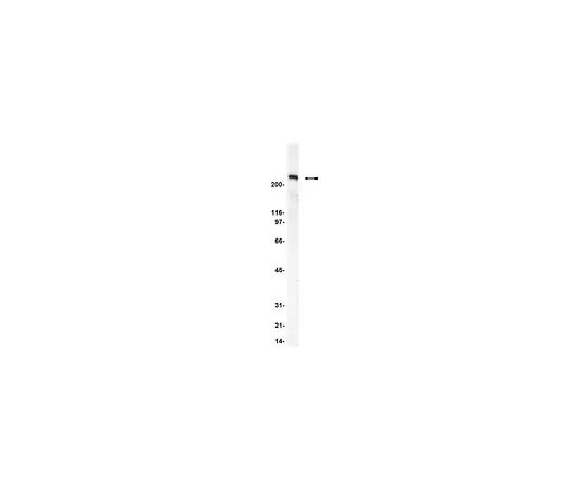 62-8383-67　［已停用］抗mAKAP;200μg　07-087