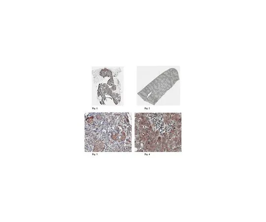 62-8456-50　［已停用］抗卡利司他汀;100μg　ABC51