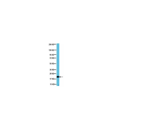 62-8374-38　［已停用］抗ADP-Ribosylation因子6,克隆6ARF01;100μg　05-1149