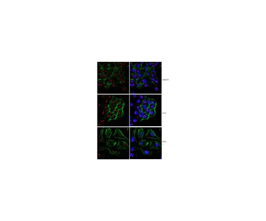 62-8390-13　［已停用］抗PHD指蛋白8;200μL　09-868