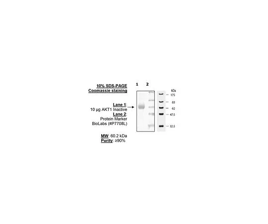 62-8391-33　［已停用］AKT1,不活动　14-279-D