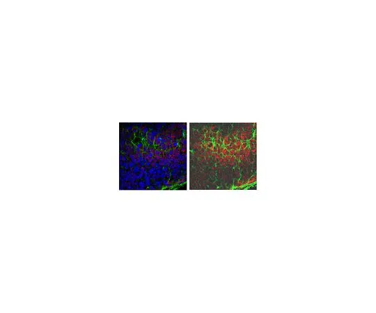 62-8459-49　［已停用］抗B-myb;100μg　ABD32