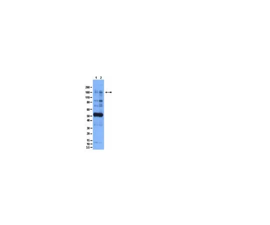 62-8389-70　［已停用］抗磷-IRS1 (Ser636/Ser639);200μL　09-430