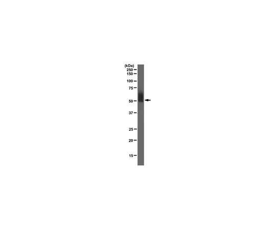 62-8369-55　［已停用］抗IL-6Rα，克隆1C2;100μg　04-1581