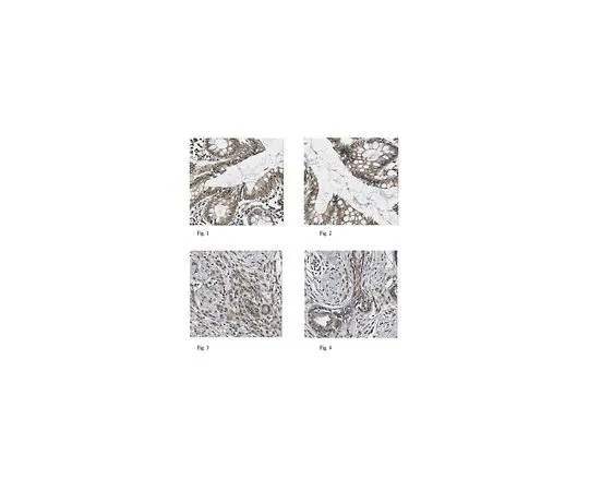 62-8457-18　［已停用］反WISP-1　ABC223