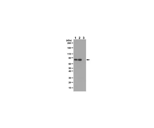 62-8386-88　［已停用］抗磷-PKCβII (Thr641)　07-873-I