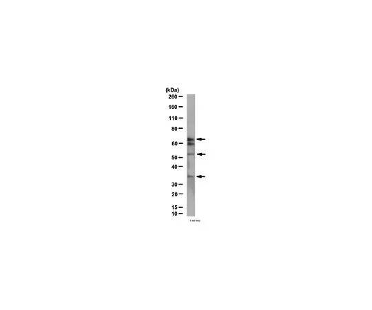 62-8382-70　［已停用］抗MAVS/Cardif, N末端;100μL　06-1043