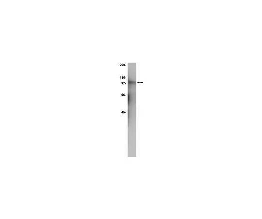 62-8382-49　［已停用］抗STAT5B;100μL　06-969