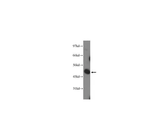62-8466-36　［已停用］反PANX1　ABN270
