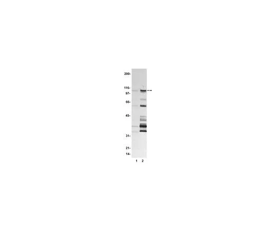 62-8391-38　［已停用］FKHR;100μg　14-343