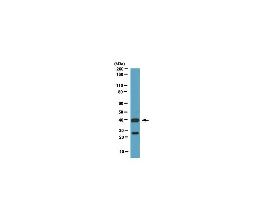 62-8460-41　［已停用］抗HOX-D10;100μL　ABE128
