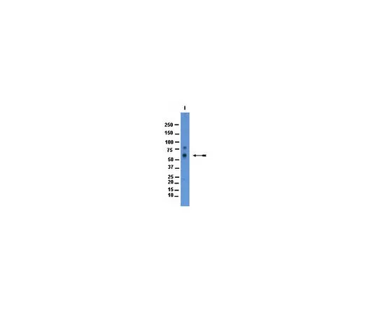 62-8446-50　［已停用］抗牛磺酸转运蛋白;100μg　AB2235