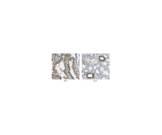 62-8473-20　［已停用］抗IQGAP1抗体猫。不，是ABT186　ABT186