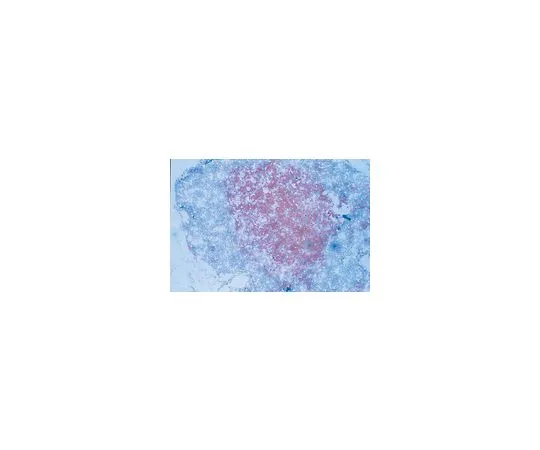 62-8493-27　［已停用］抗VCAM-1,克隆P3C4;100μg　MAB2144