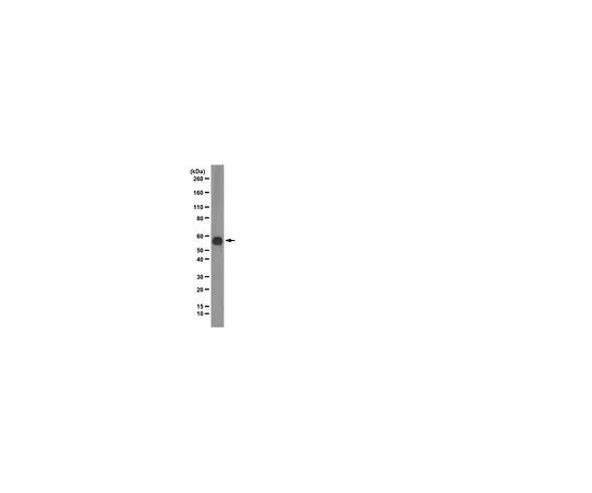 62-8493-44　［已停用］抗合成素，克隆1351;100μg　MAB2237