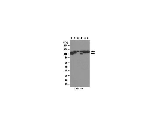 62-8472-33　［已停用］抗泛钙蛋白;100μg　ABT35