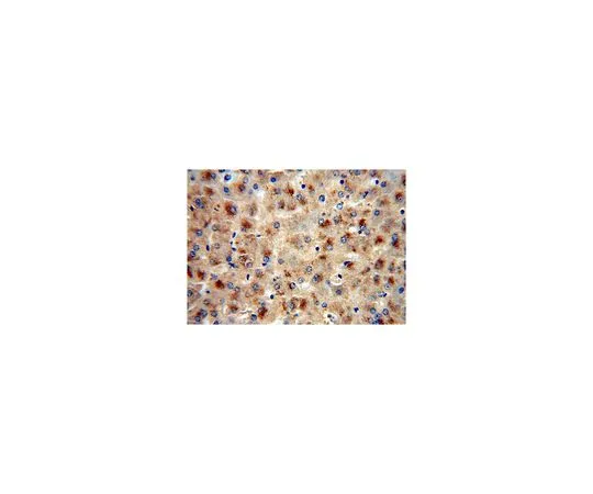 62-8457-94　［已停用］反FETUB　ABC388