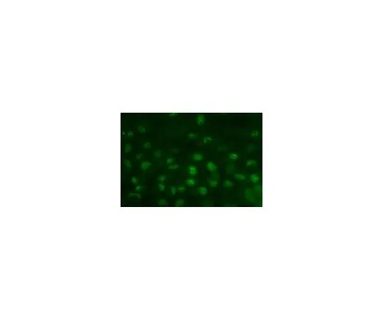 62-8490-70　［已停用］抗核仁克隆125-10;100μL　MAB1277