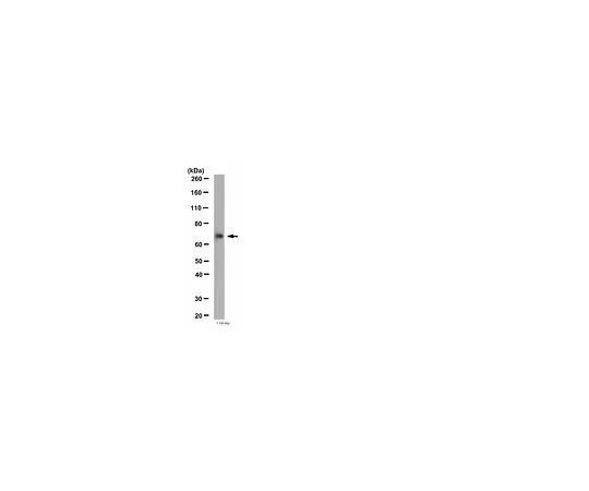 62-8455-13　［已停用］抗烟碱乙酰胆碱受体β4;100μg　AB15327
