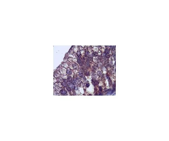 62-8465-22　［已停用］Anti-Ca (v) 1.3α1亚基;100μg　ABN11