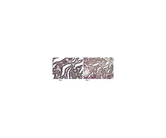 62-8452-44　［已停用］抗阿尔法中心蛋白 (ARP1);50μg　AB6058