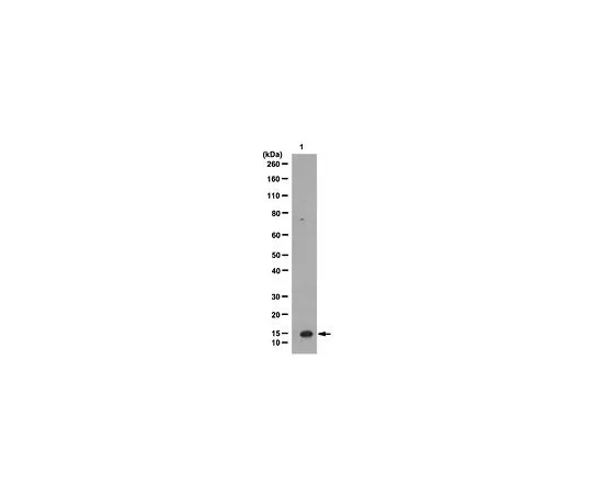 62-8382-57　［已停用］抗VMA21;100μg　06-1008