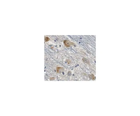 62-8466-94　［已停用］抗SSBP1抗体猫。不，是ABN403　ABN403