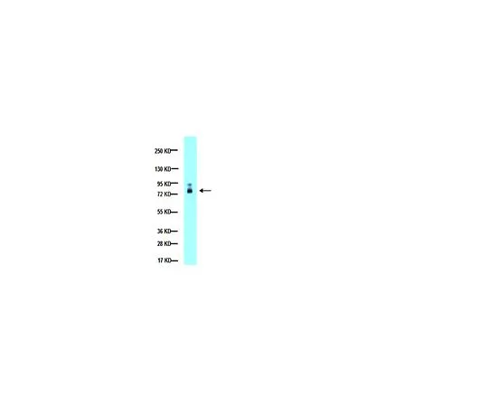 62-8456-26　［已停用］抗MMP-2,全分子;100μg　AB19167