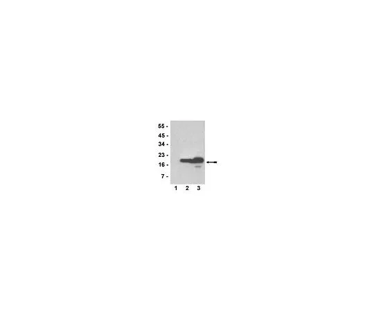 62-8385-53　［已停用］抗三甲基 (Lys79) -磷酸 (Thr80) -组蛋白H3;100μL　07-528