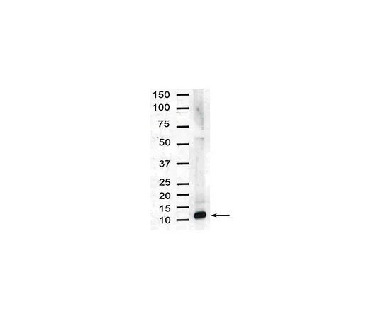 62-8444-96　［已停用］抗白介素-8;100μg　AB1427