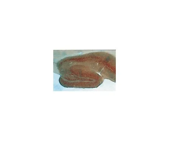 62-8445-41　［已停用］抗GABA转运蛋白-3, C末端;10μg　AB1574