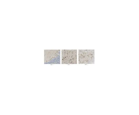 62-8384-25　［已停用］反弧SH3/SH2　07-262-I