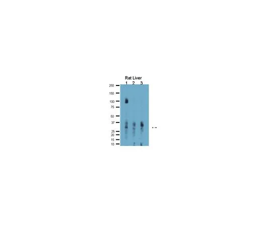 62-8454-13　［已停用］抗水通道蛋白9;100μg　AB10141