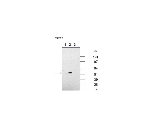 62-8367-50　［已停用］RIPAb+ (TM) Hexim 1;10次检测　03-177