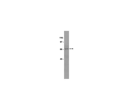 62-8372-69　［已停用］抗cdc25A,克隆DCS120;100μg　05-743