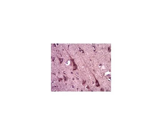 62-8465-73　［已停用］抗Neuxin2;100μg　ABN97