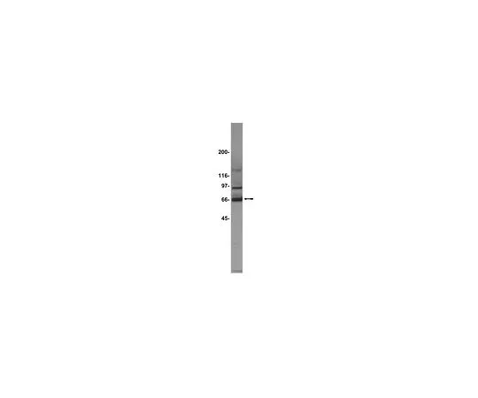 62-8383-83　［已停用］抗PKR;200μg　07-151