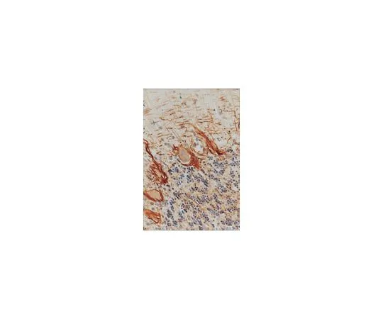 62-8491-41　［已停用］抗神经丝H和M,磷酸化，克隆NP1;100μL　MAB1592
