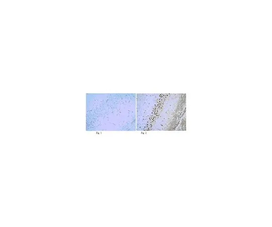 62-8465-67　［已停用］抗磷-NR1 (Ser896);100μg　ABN88