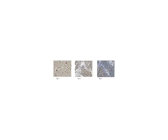 62-8466-33　［已停用］抗ALK酪氨酸激酶受体抗体猫。不，ABN263　ABN263